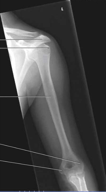<p>What projection, position, and anatomy is this?</p>