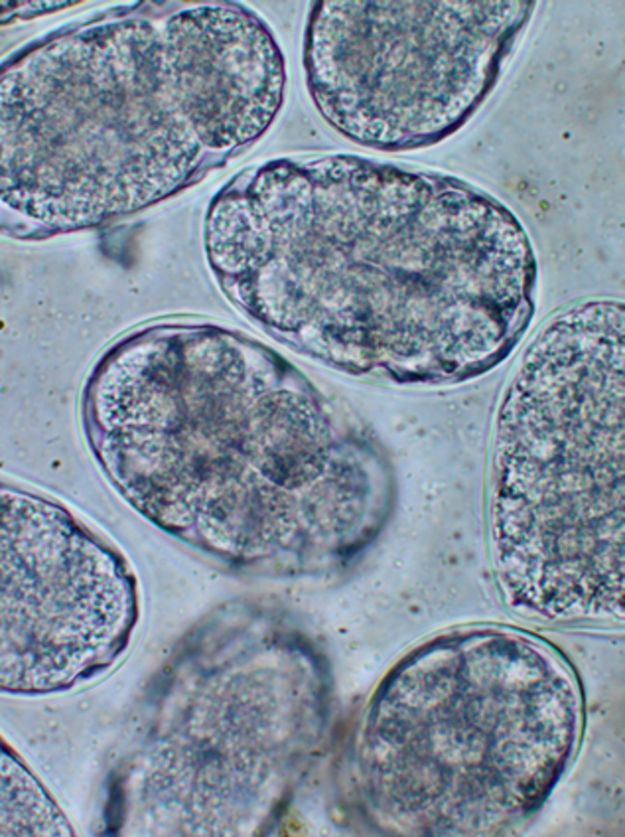 <p>Identify these eggs found on the fecal examination of a 4-week-old puppy with a profound anemia. They measure approximately 60 x 40 um</p>