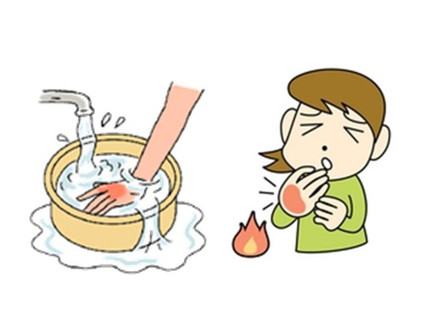 <p>I burned myself</p>