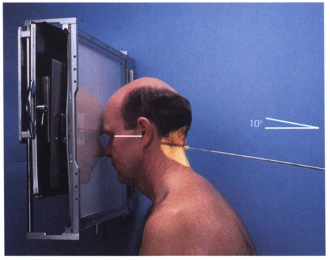 <p><span style="color: oklch(0.3039 0.04 213.68);">The PA axial projection central ray is directed to exit the ______________ at a 10-degree _________________ angle.</span></p>