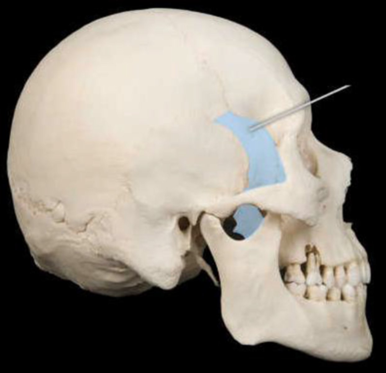 knowt flashcard image