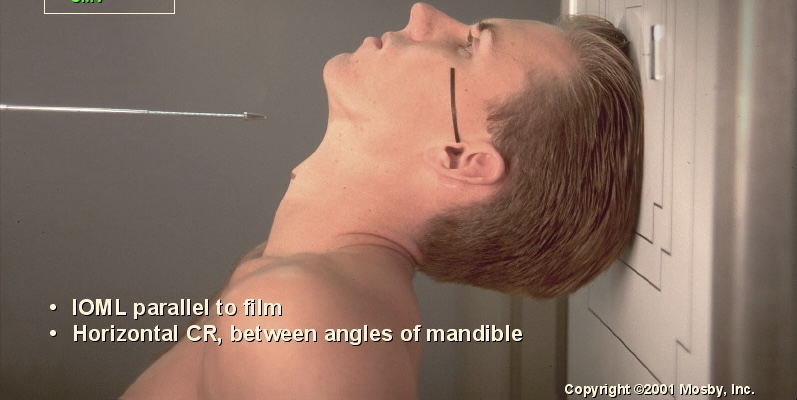 <p>What position is this?</p>