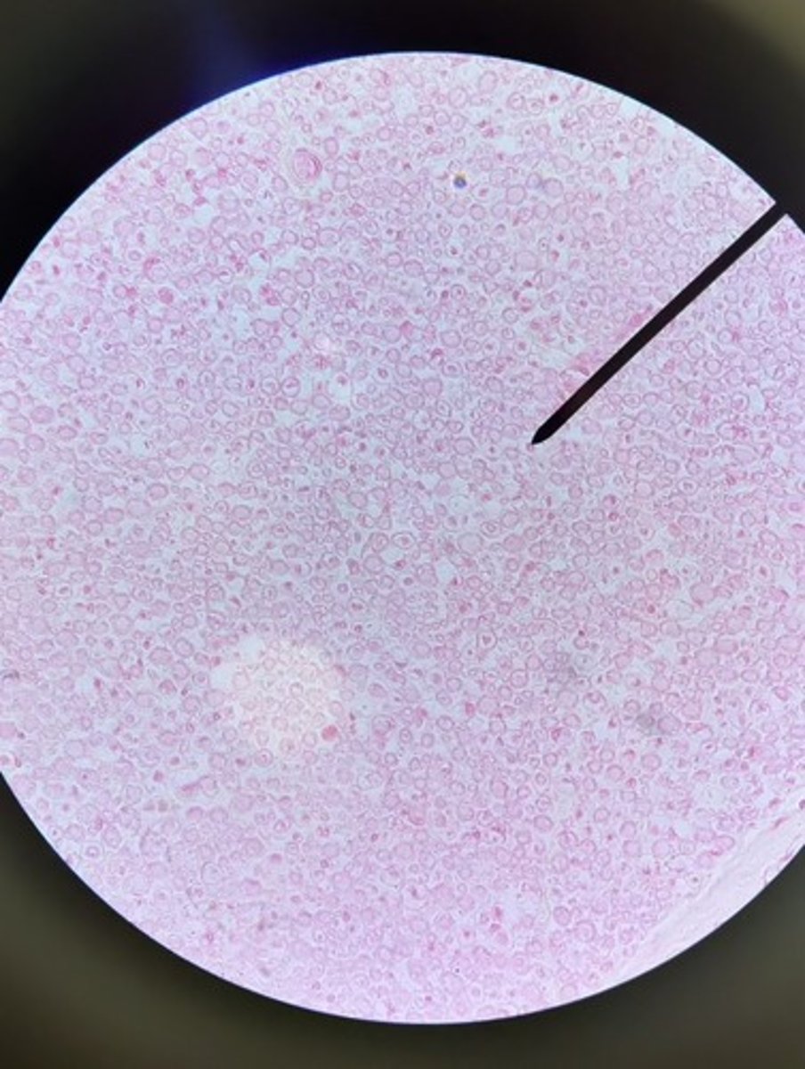 <p>1. What is the structure at the pointer (pink dot)?</p><p>2. What is the white area surrounding the pink dot?</p><p>3. What connective tissue layer would be found surrounding #1 and #2?</p>