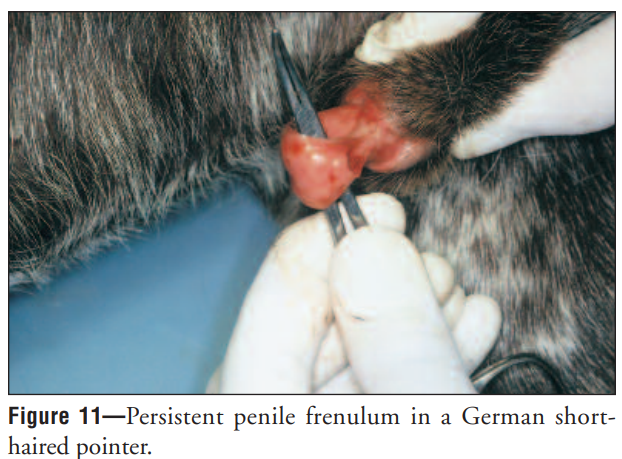 <p>Abnormal curvature of the penis, sometimes seen with phimosis.</p>