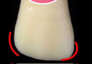 <p>which incisal angle is more rounded?</p>