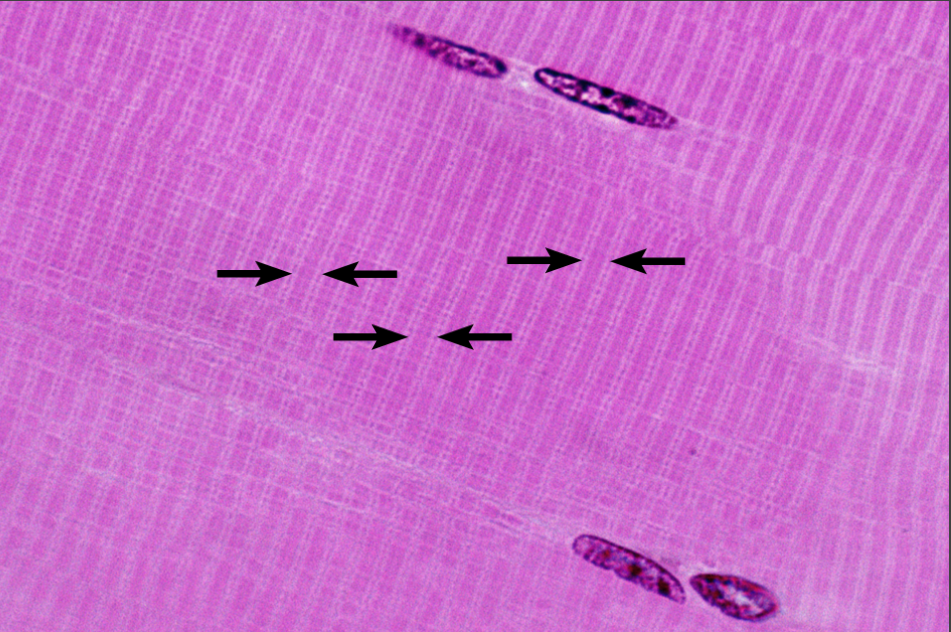 <p>What is this highlighting</p>