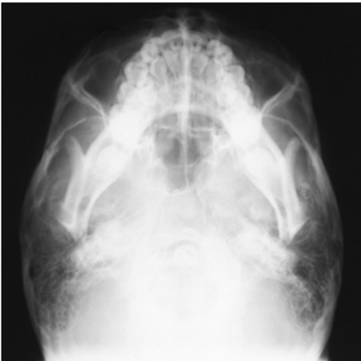 <p>Repeatable errors (two)—</p><p>Criterion 2: Positioning: Skull is underextended (IOML was not parallel to IR and was not perpendicular to CR). Mandible is foreshortened, and rami are projected into temporal bone. </p><p>Criterion 5: Anatomic side markers: No anatomic side marker is visible</p>