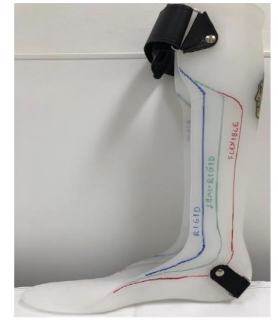 <p><span data-name="black_small_square" data-type="emoji">▪</span> Limitations in DF ROM without breaking down midfoot</p><p><span data-name="black_small_square" data-type="emoji">▪</span> PF weakness/poor tibial control</p><p><span data-name="black_small_square" data-type="emoji">▪</span> Likely to need continued sagittal plan control (can be </p><p>trimmed to semi-rigid/PLS)</p>
