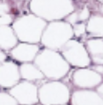 <p>What tissue type does this image depict?</p>