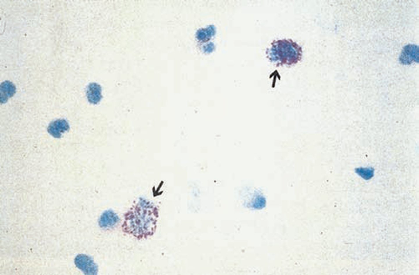 <p>Methylene blue &amp; eosin Y stains eosinophilic granules. (identifies urinary eosinophils)</p>
