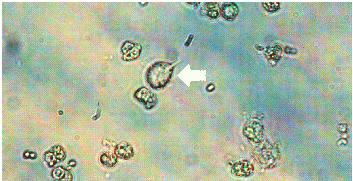 term image
