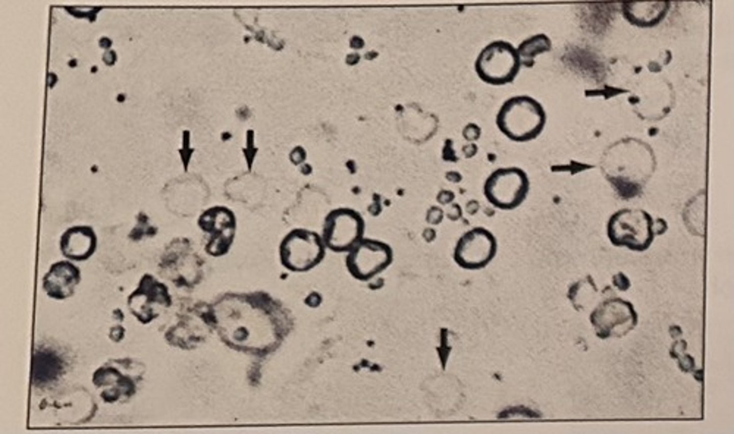 <p>b. ghost cells</p>