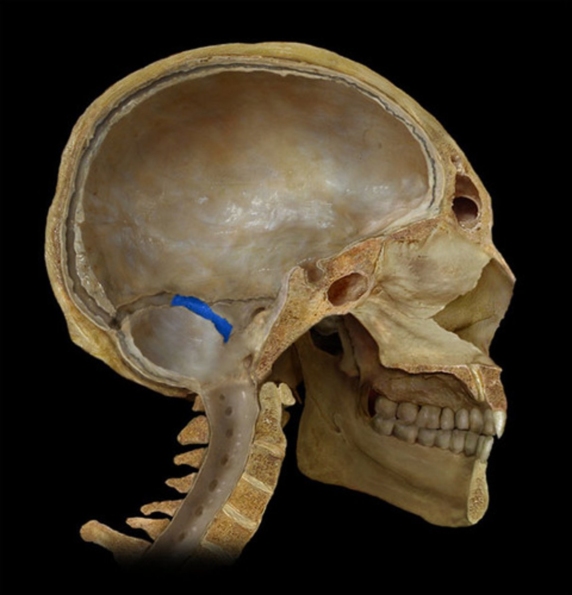 <p>-S shaped course in posterior fossa</p><p>-can see grooves in skull</p><p>-flows into IJV</p>
