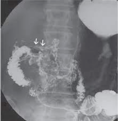 <p>What is this </p>