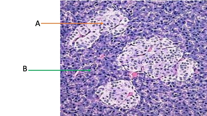 <p>If tissue A was destroyed by a toxin…</p>