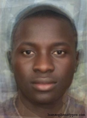 <p>Identify this Phenotype</p>
