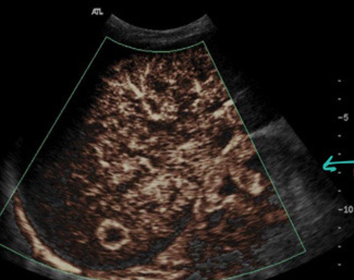 <p>What does this image show</p>