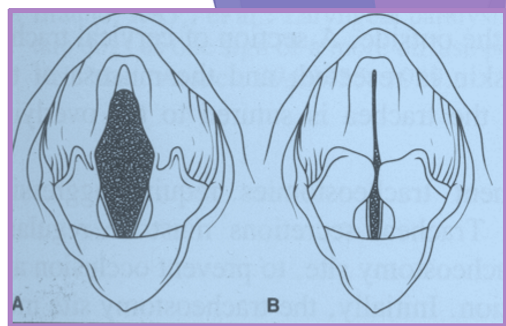 <p>Laryngeal paralysis examination </p>