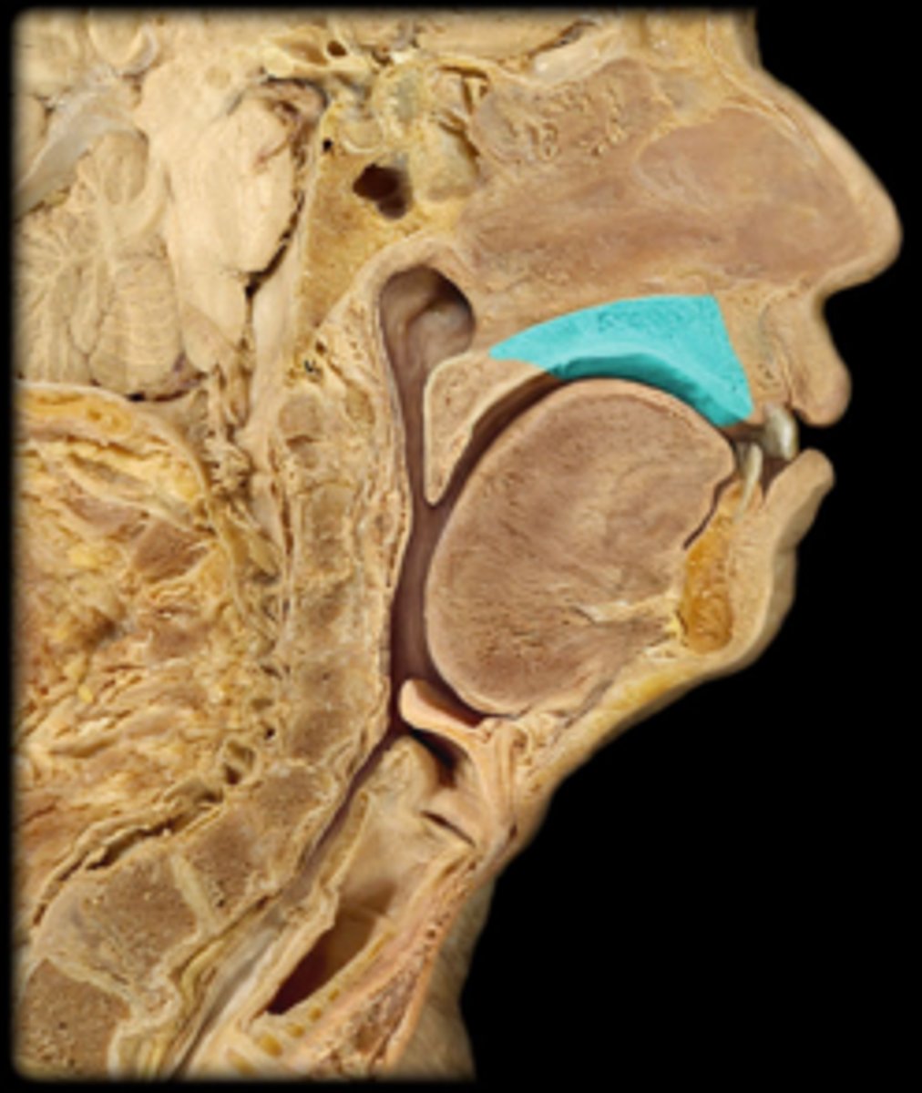 <p>Identify this structure.</p>