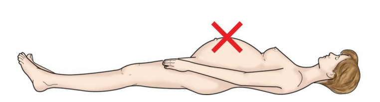 <p>The level of anesthesia achieved via epidural anesthesia for a vaginal birth is T10 (approximately the level of the umbilicus). Epidural anesthesia for a cesarean birth would be at the level of T4 to T6, approximately the nipple line.</p>