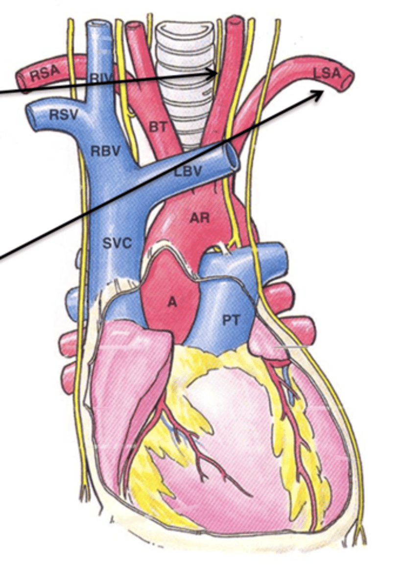 <p>The final branch off the aortic arch is the ___ ___ ___ which supplies the left upper limb.</p>
