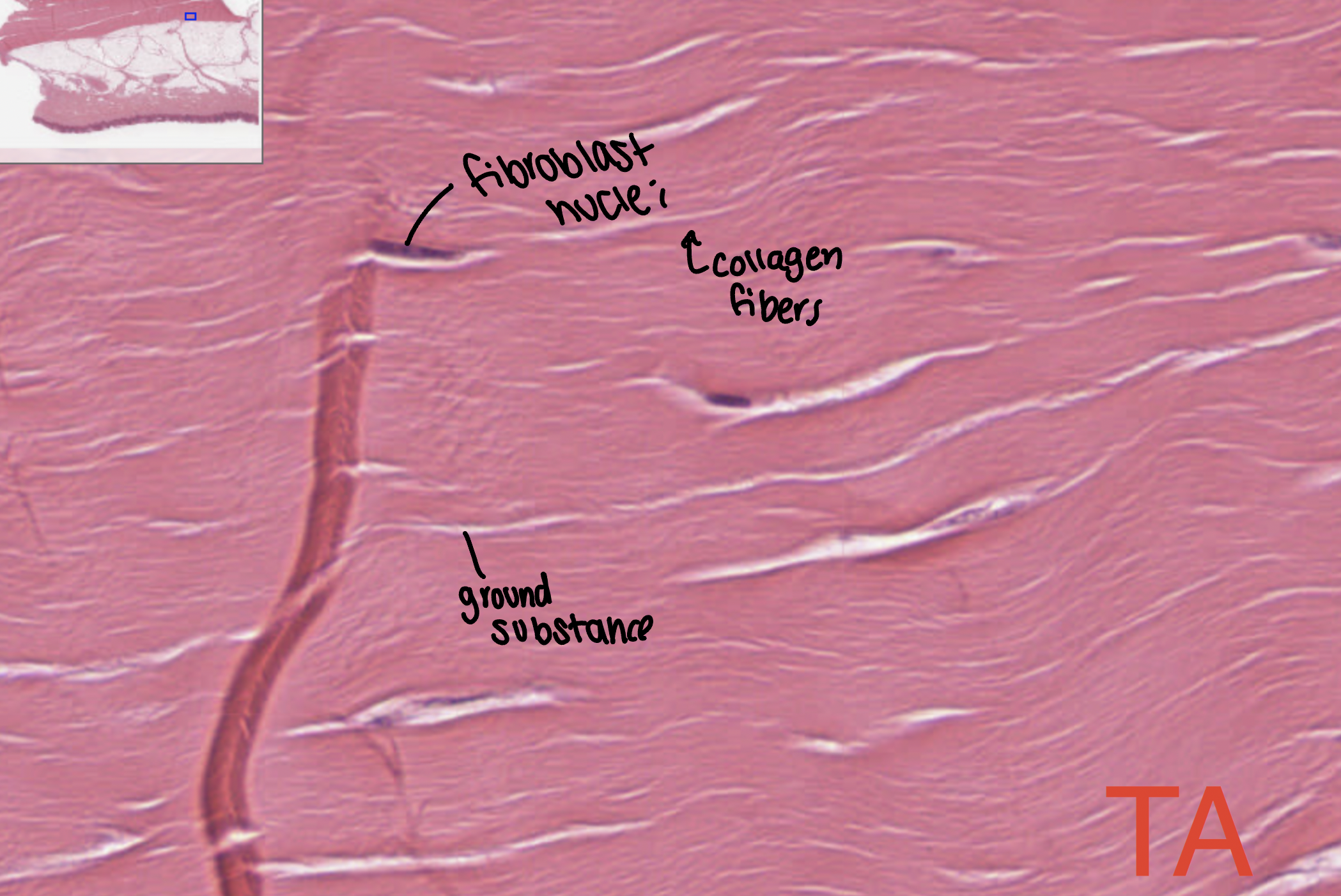 <p>ligaments and muscle tendons</p>