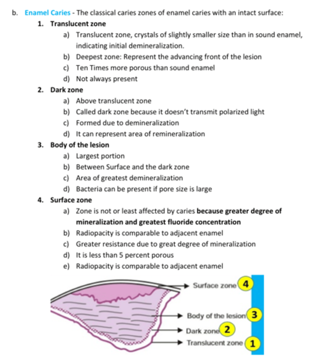 <p>Just for review</p><p>Zones of Enamel Caries</p>