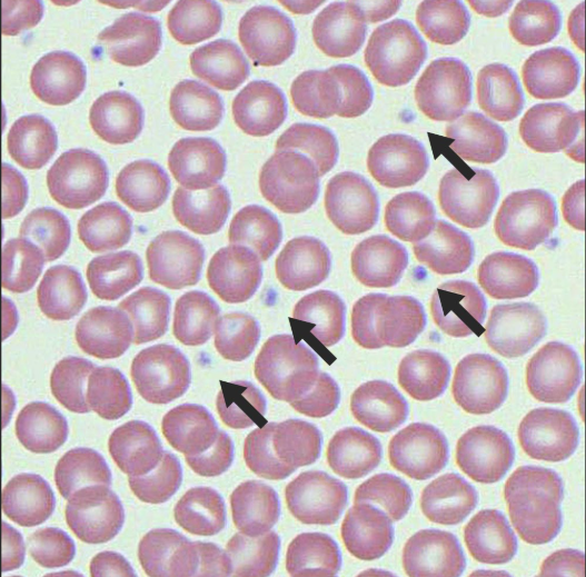 <p>also called a thrombocyte&nbsp;</p>
