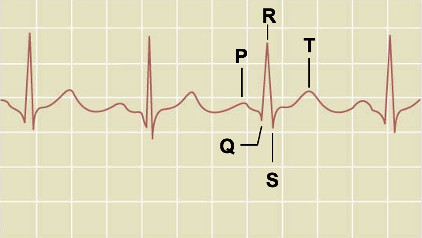 <p>Label ECG </p>