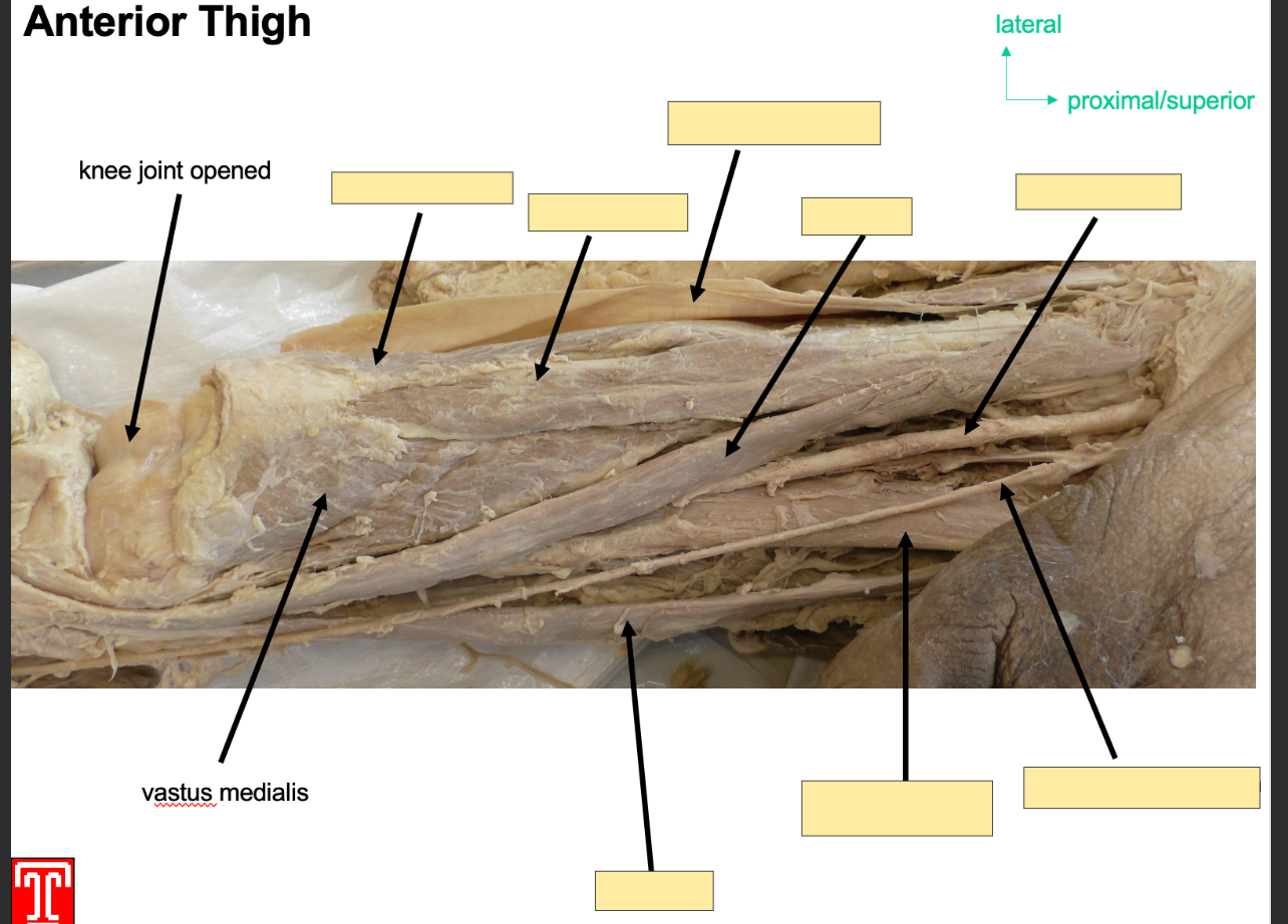 <p>Part of the quadriceps</p><p></p><p>Attachments:originates from interoctrochonateric line and medial lip of liniea aspera</p><p></p><p>Action: Extention of Knee joint and stabalizing patella</p><p></p><p>Innervation: femoral nerve</p><p></p><p>Artery: femoral artery</p><p></p>