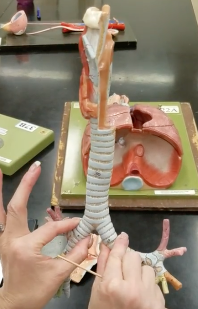 <p>Name of 2 structures being pinched</p>