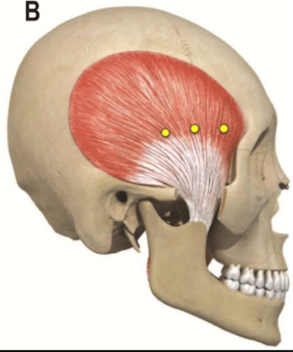 knowt flashcard image