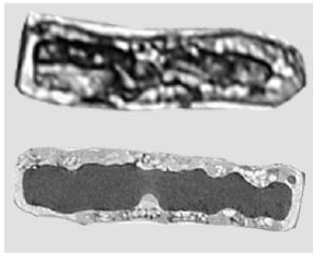<p><span>The images are microscopic views of two similar cells.&nbsp;What is a reason for the differences between the two micrographs?</span></p>