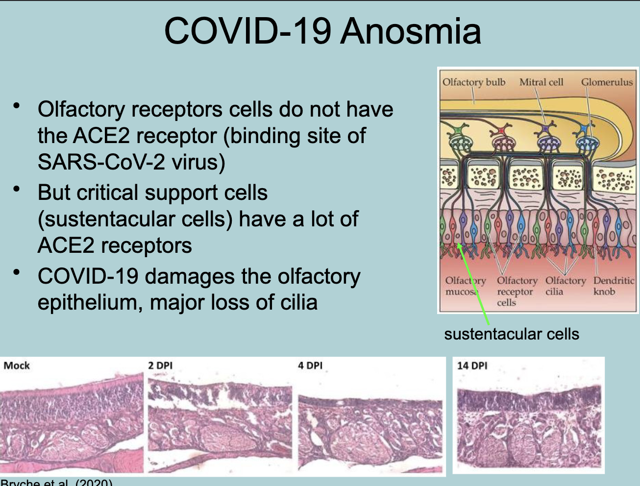 <p>COVID-19 Anosmia</p><ul><li><p>Olfactory receptors cells do not have the ACE2 receptor (binding site of SARS-CoV-2 virus)&nbsp;</p></li><li><p>But critical support cells (SUSTENTACULAR cells) have a lot of ACE2 receptors</p></li><li><p>COVID-19 damages the olfactory EPITHELIUM, major loss of CILIA&nbsp;</p></li></ul><p></p>
