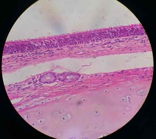 <p>pseudostratified epithelial (epithelial)</p>