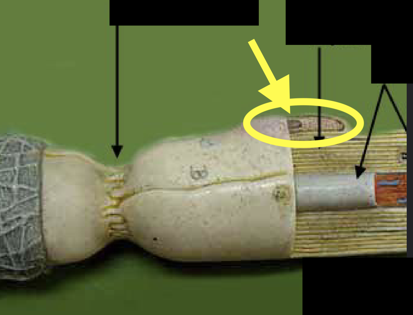 <p>What part of the neuron is this?</p>