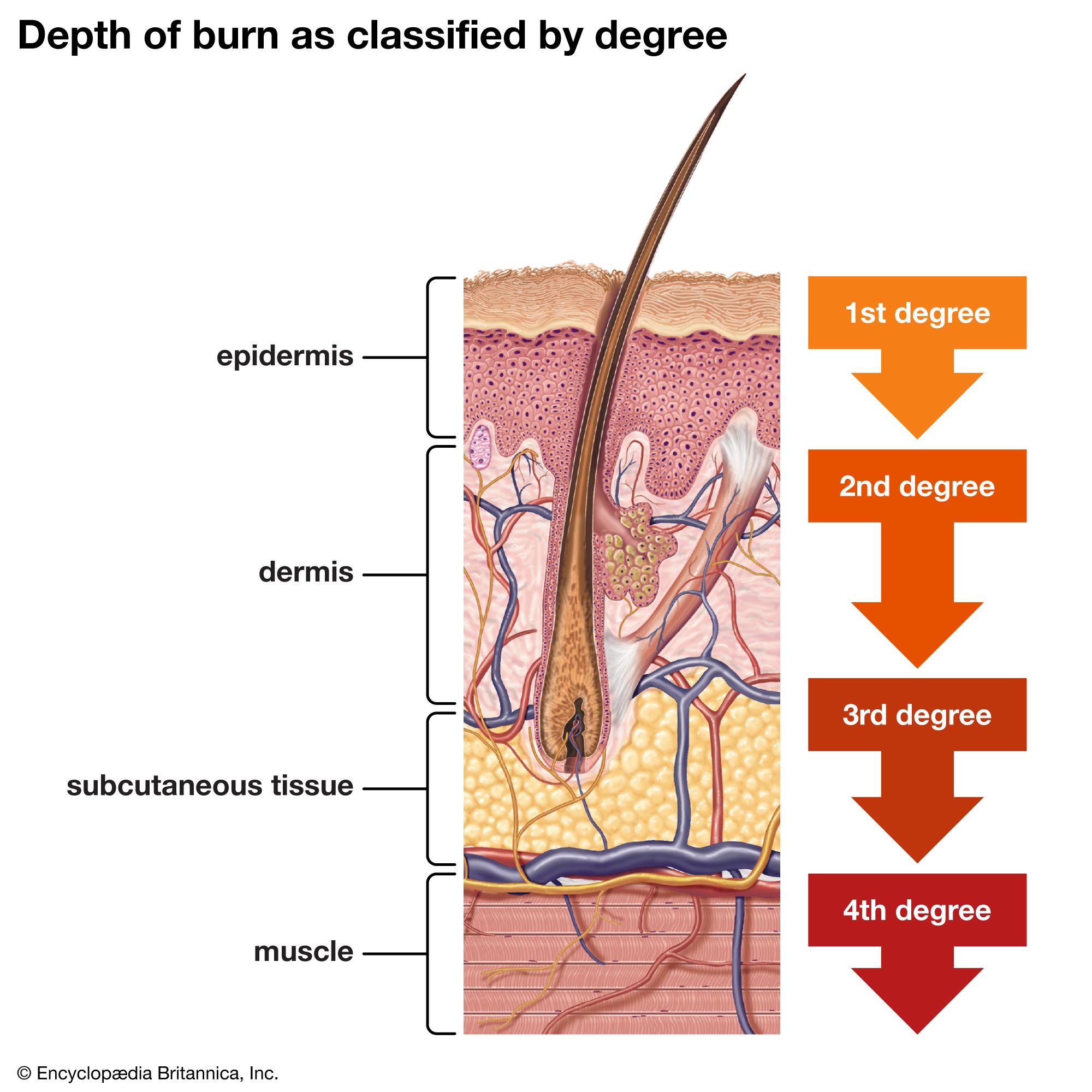 <p>The deeper skin layer beneath the epidermis.</p>