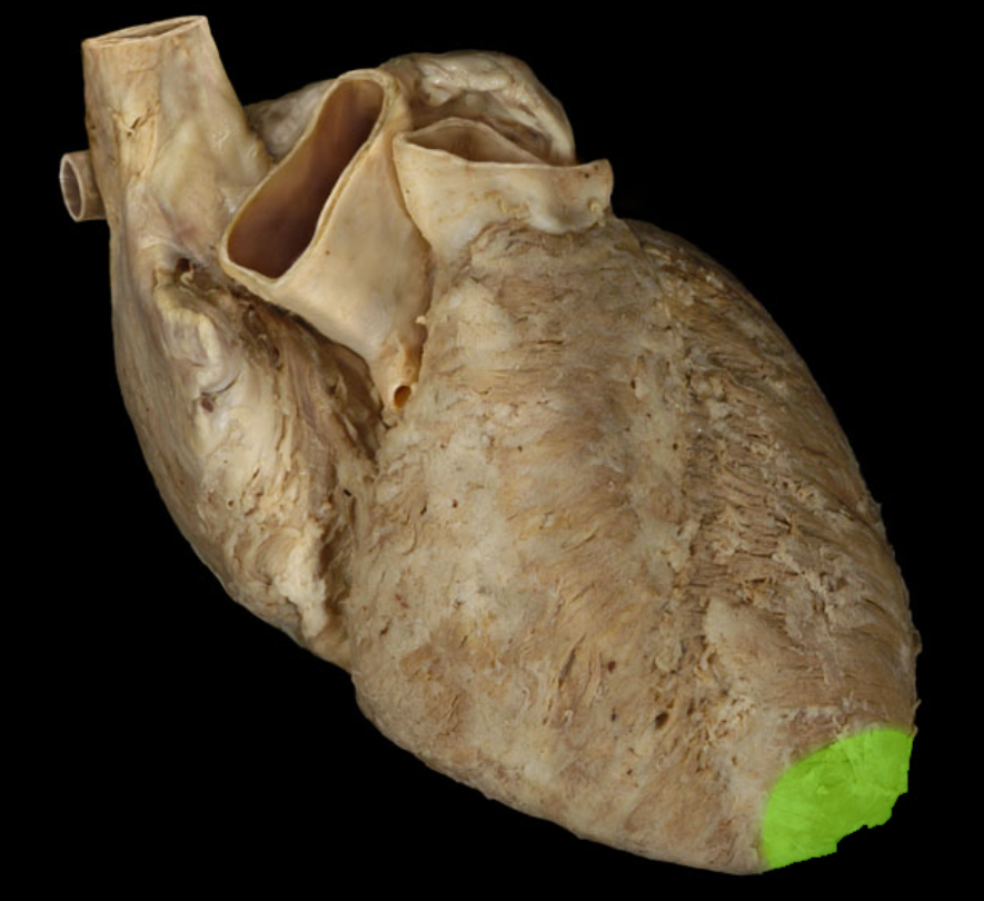 Lab Heart Anatomy Flashcards Knowt