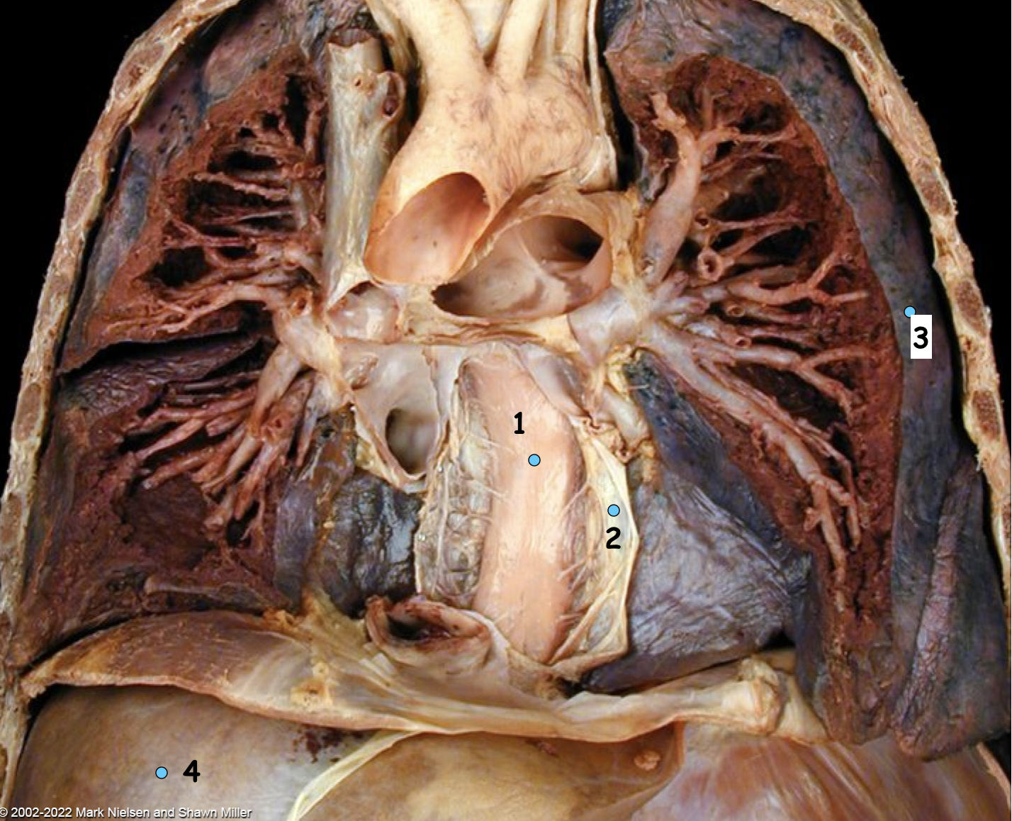 <p>What is number 3</p>