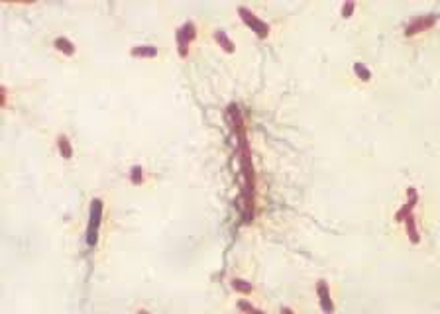 <p>Gran negative rods</p><p>Causes chronic UTIs (males with stones), struvite crystals, otitis externa, wound infections, occasionally pneumonia or septicaemia</p>
