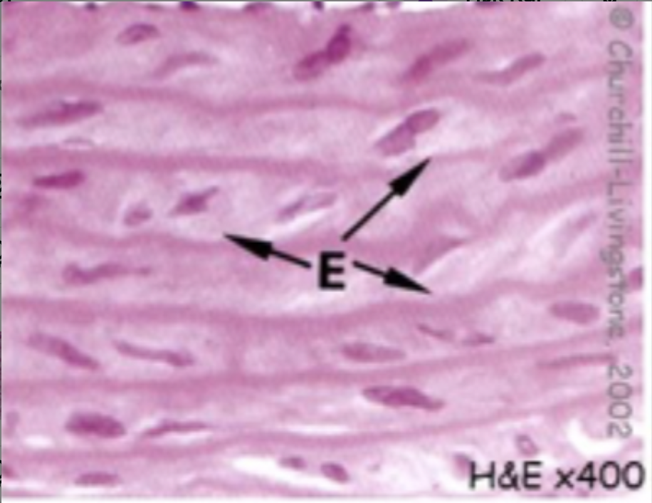 <p>high concentration of elastic and collagen fibres</p>
