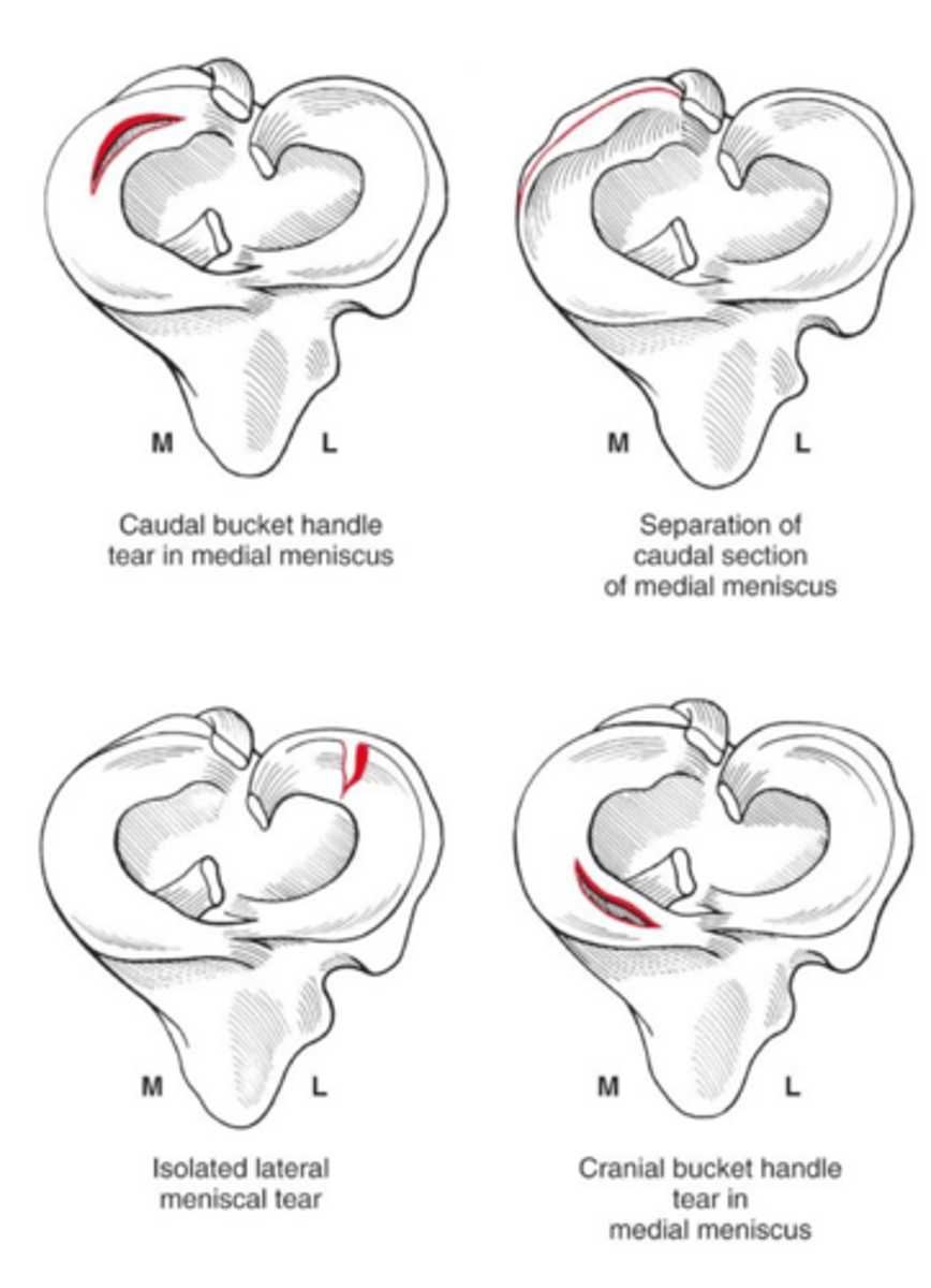 <p>what is meniscal release</p>