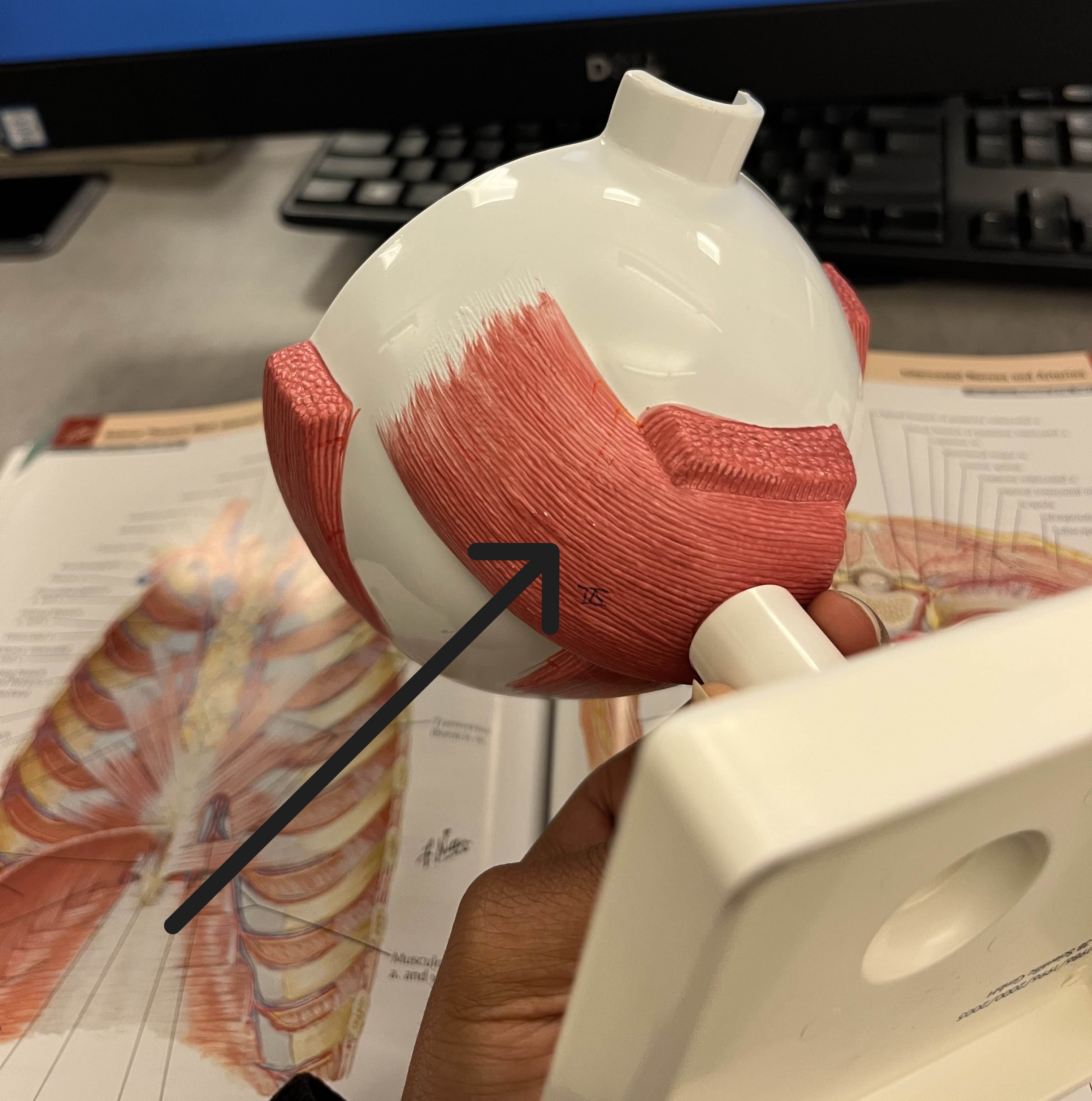 <p>Which muscle of the eye is:</p><ul><li><p>Bottom tail, attach on lateral side</p></li><li><p>Action: eye looks up &amp; lateral</p></li><li><p>Nerve: <span style="color: yellow;">CN III</span></p></li></ul><p></p>