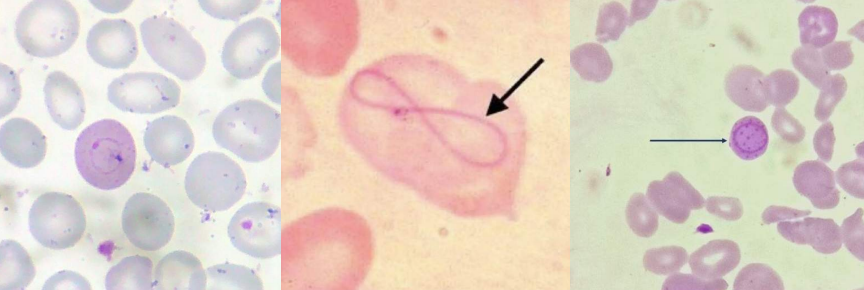 <p>A. Identify the cell<br>B. Identify the disease / condition<br>C. Composition of Inclusion</p>