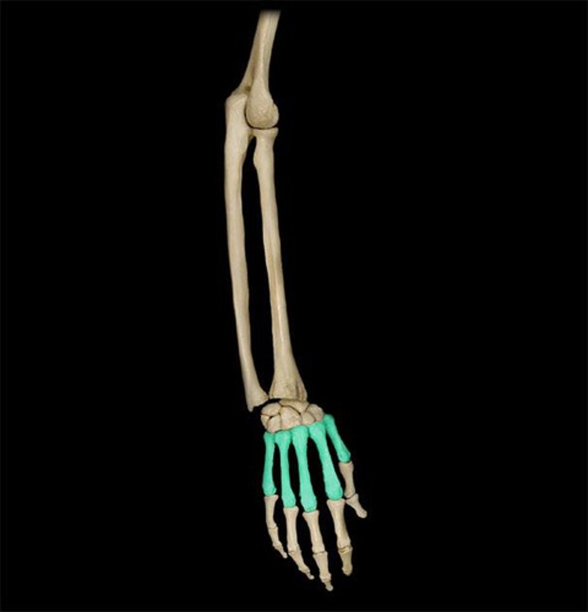 <p>What is the term of the bones highlighted in green?</p>