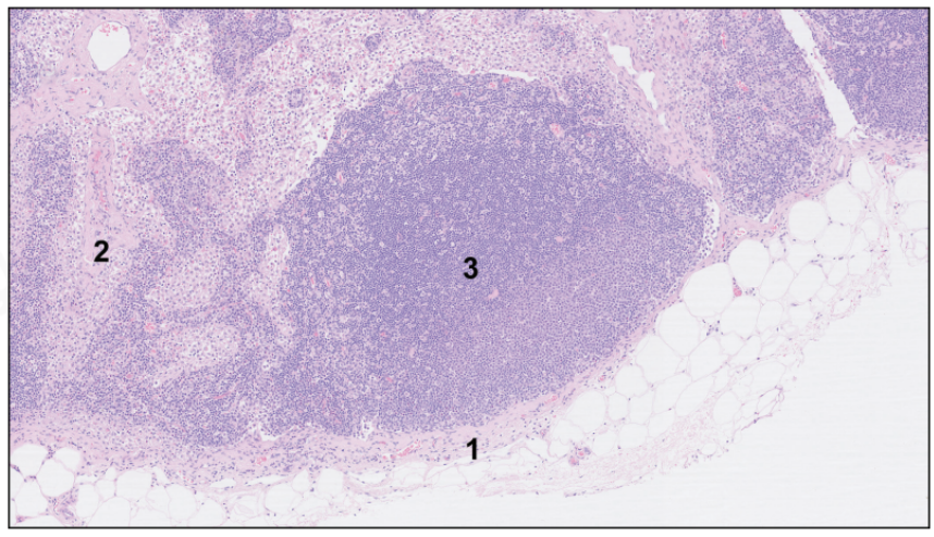 <p>lymph node, dog</p>