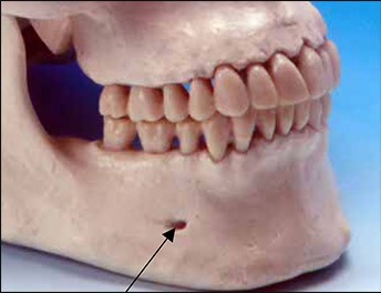 <p>_______ Foramen</p>