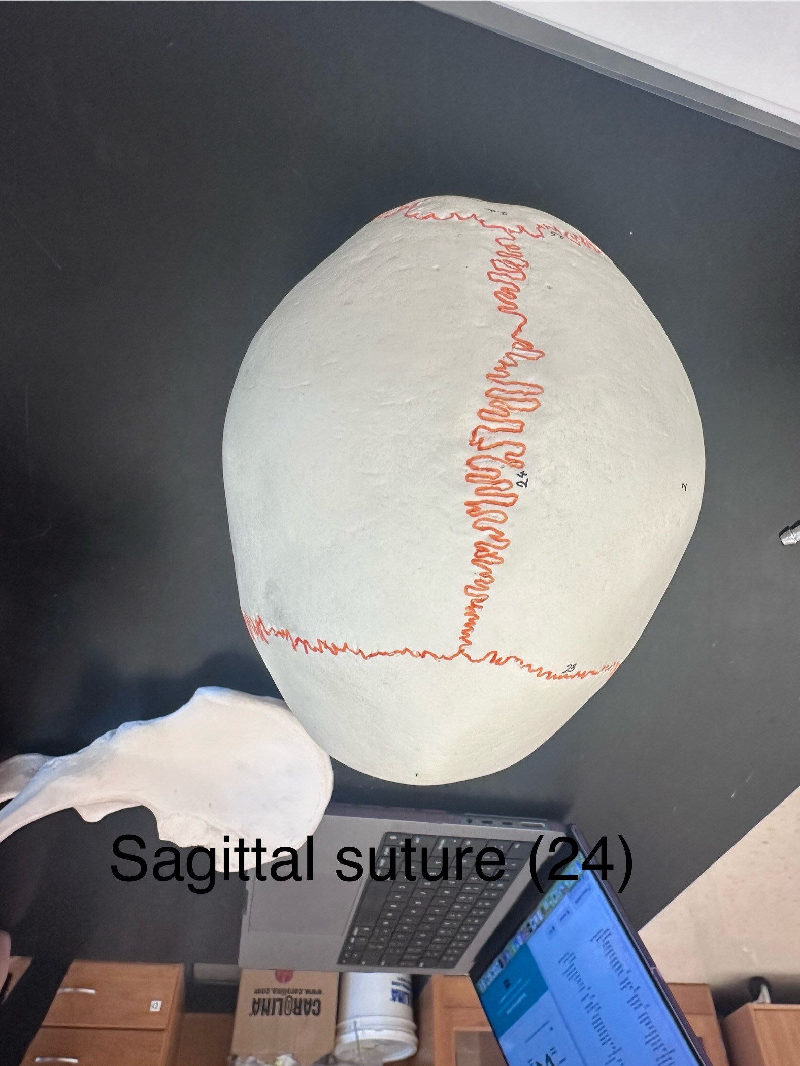 <p>Sagittal Suture</p>