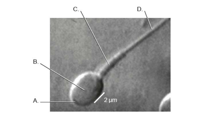 <p><strong>HL&nbsp;</strong>The micrograph shows part of a human sperm cell. Which region/regions of the cell is responsible for the cell's need for a large production of ATP?</p>