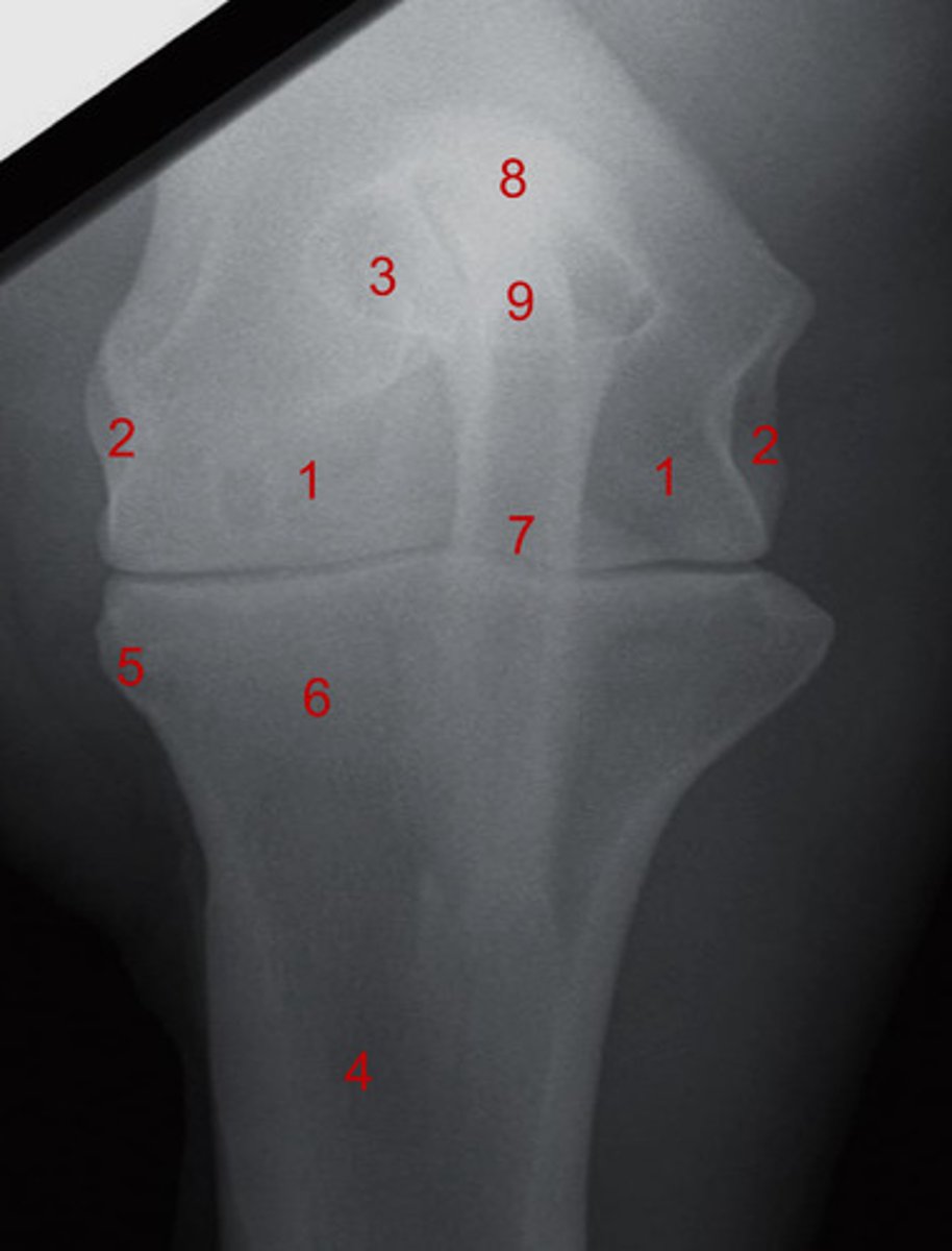 <p>What is 5?</p>